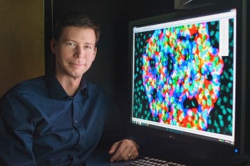 Curing diabetes with stem cells